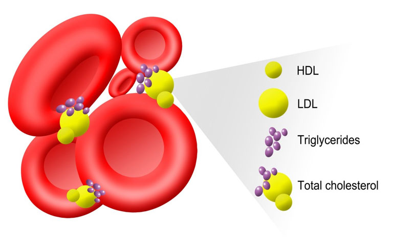 What You Need To Know About Cholesterol