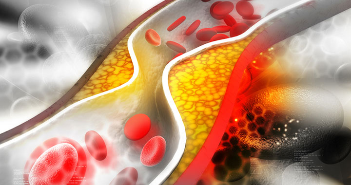 What You Need To Know About Cholesterol