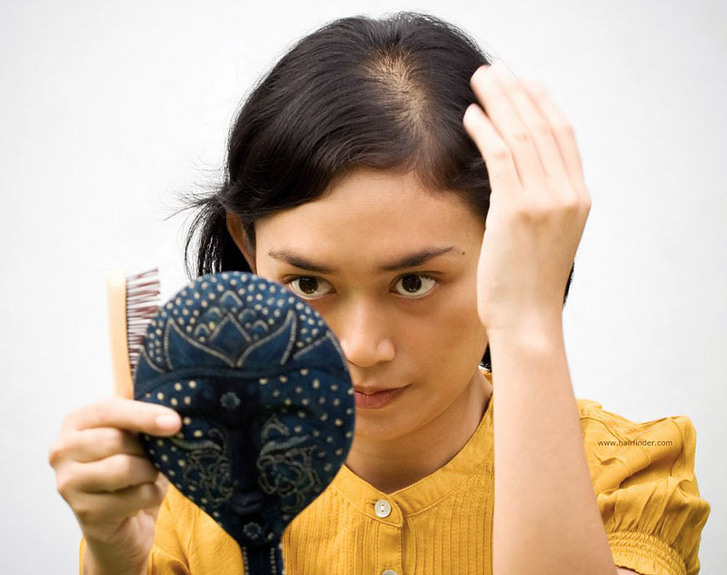 10 Reasons Why Women Too Suffer From Hair Loss