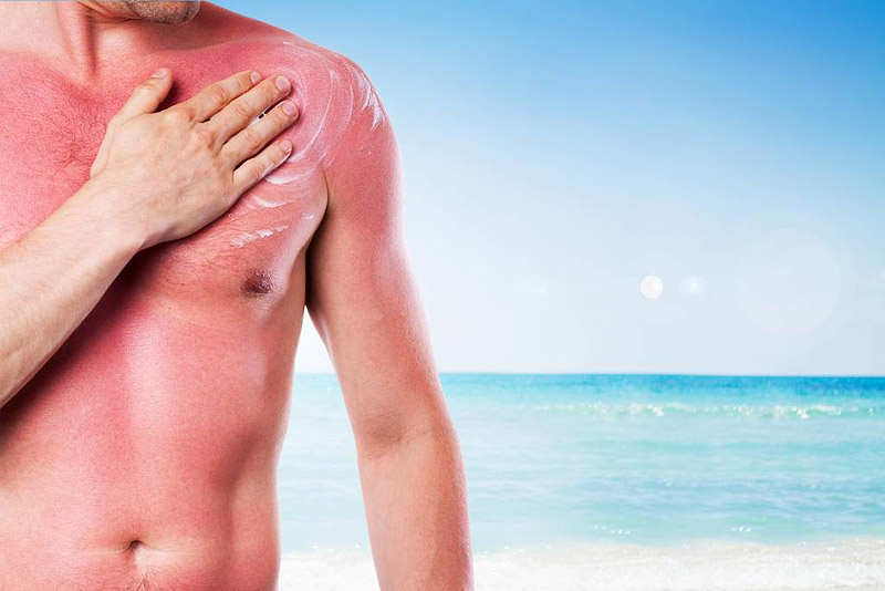 6 Common Summer Health Myths Busted Once & For All