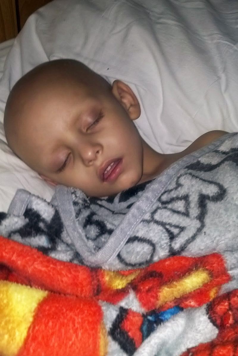 Cannabis Oil Cures 3 Year Old Boy Of Cancer