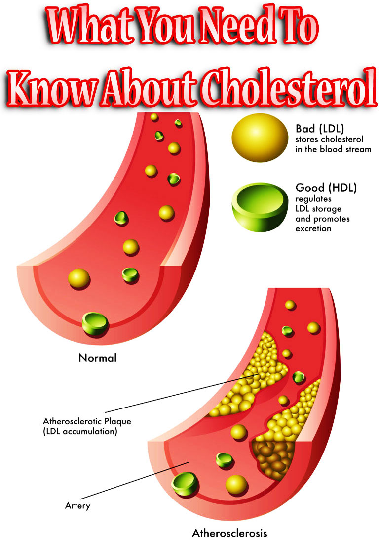 What You Need To Know About Cholesterol