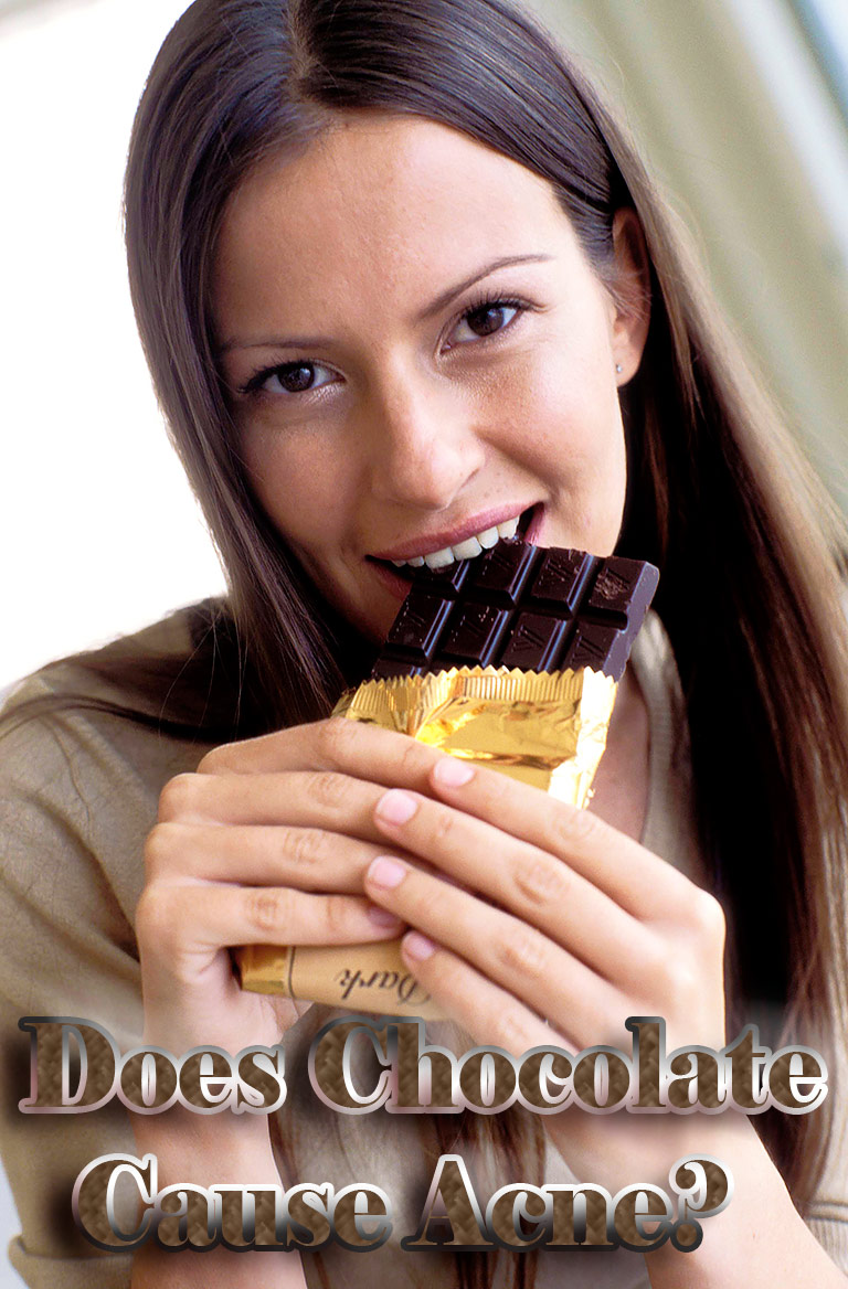 Does Chocolate Cause Acne?