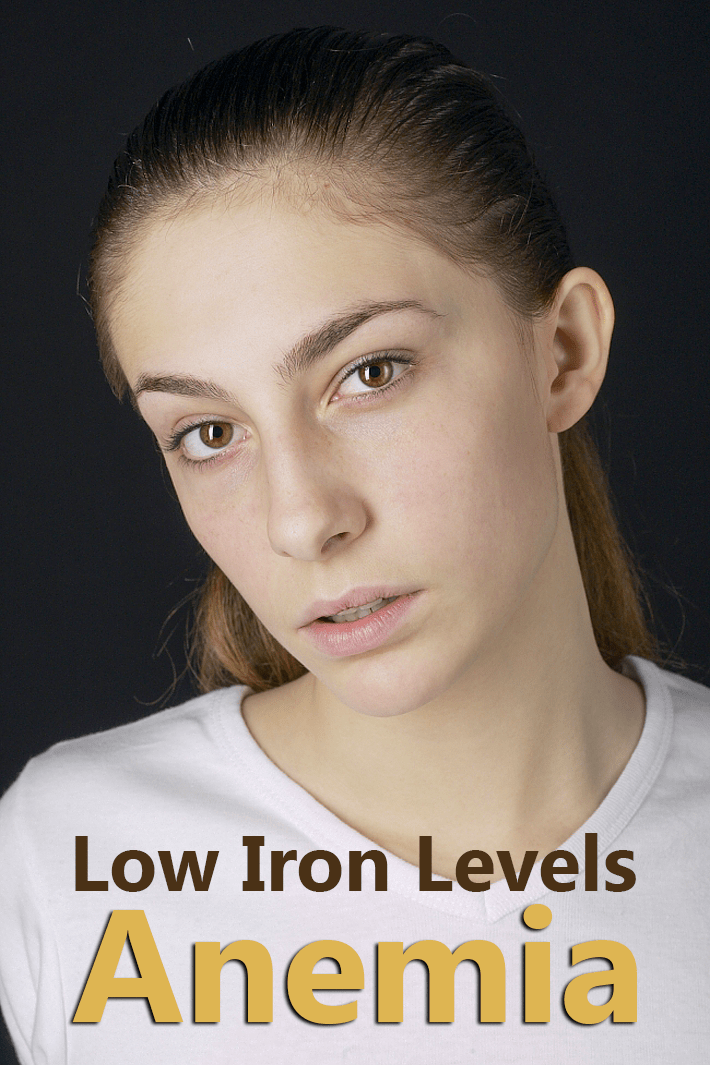 Low Iron Levels – Iron Deficiency Anemia