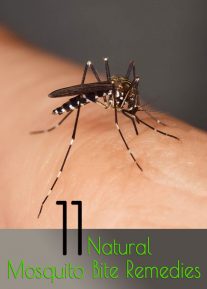 11 Natural Mosquito Bite Remedies