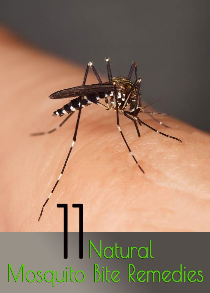 11 Natural Mosquito Bite Remedies