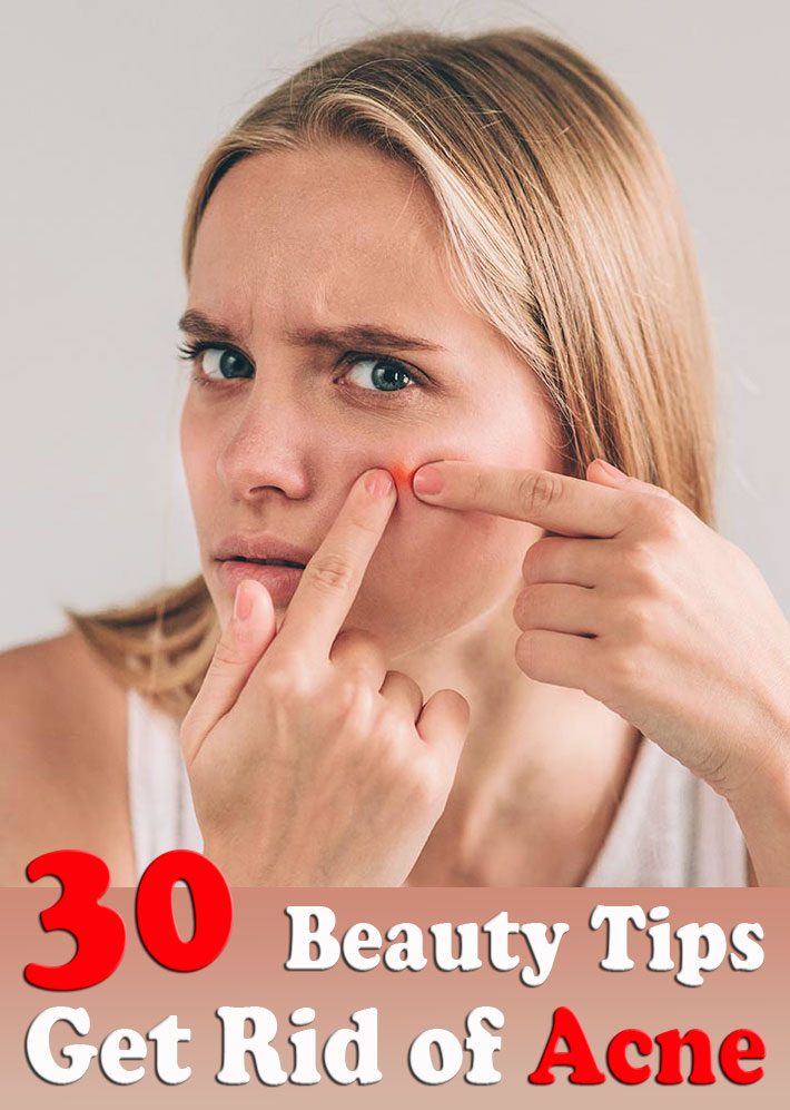 30 Beauty Tips: Get Rid of Acne for Smooth Skin