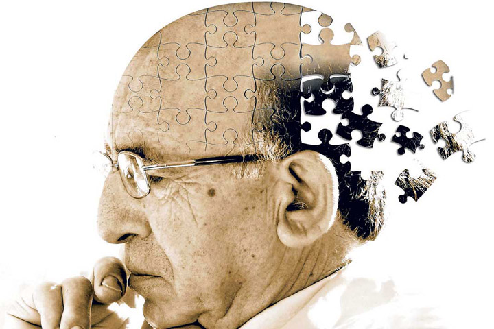 Aducanumab - Reduces plaques in Alzheimer's disease