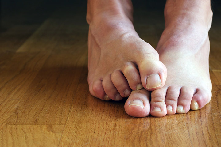 Stinky Feet? - Try These 5 Natural Remedies