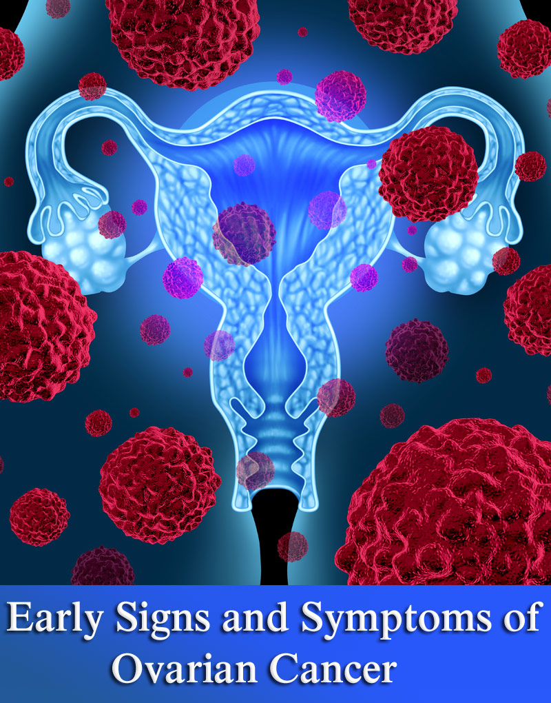 Early Signs and Symptoms of Ovarian Cancer