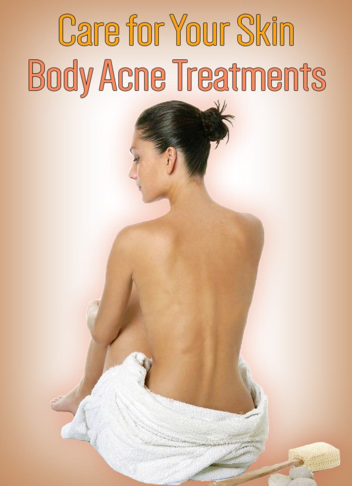 Care for Your Skin – Body Acne Treatments