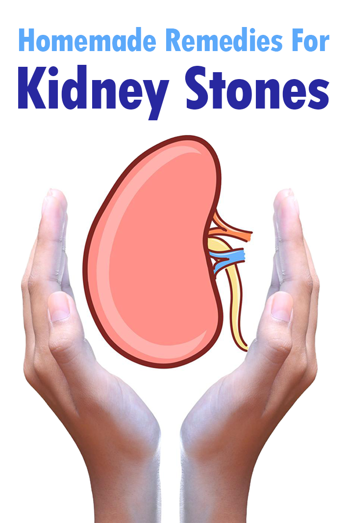 Homemade Remedies For Kidney Stones