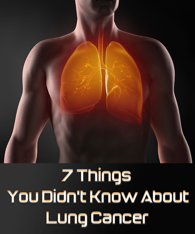 7 Things You Didn’t Know About Lung Cancer